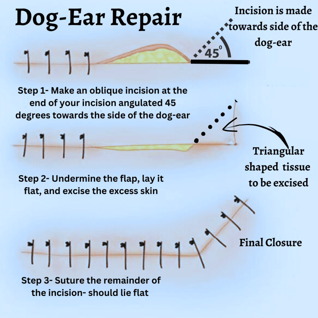 Diagram explaining the steps to repair a 'dog-ear' while suturing